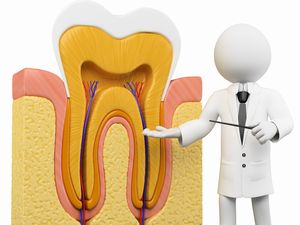 重度の虫歯でも歯を残せる可能性があります～根管治療～
