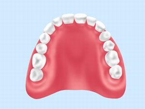 入れ歯治療について